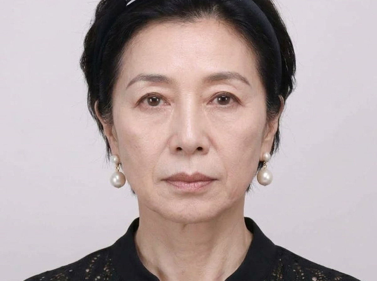 커스텀 리프팅 비교 이미지 전