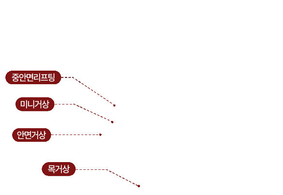 중안면리프팅, 미니거상, 안면거상, 목거상